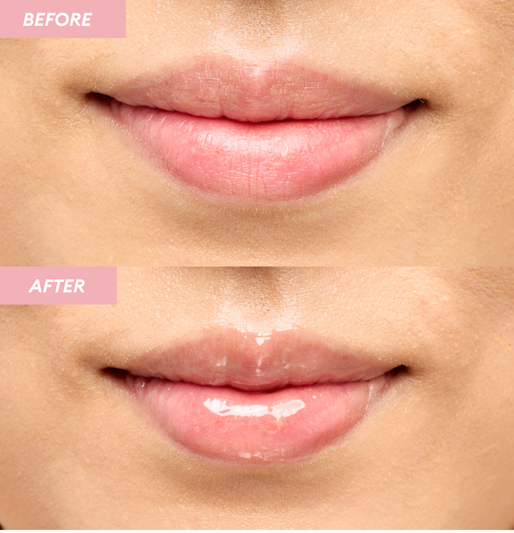 A two-part image showing lips Before application (dry, chapped lips with some discoloration) and After application (shiny, plump, and deeply moisturized lips) of the A'pieu Honey & Milk Lip Oil, demonstrating its lip-plumping and smoothing results.