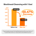 Clinical test result chart showing blackhead cleansing effectiveness of A’pieu Pore King Minji Cleansing Oil. The bar graph illustrates a 48.47% decrease in blackhead presence after one use — from 4487.273 pixels before use to 2312.182 pixels after use. Study conducted by PNK Clinical Research Center with 22 participants.